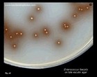 Enterococcus faecalis on bile esculin agar